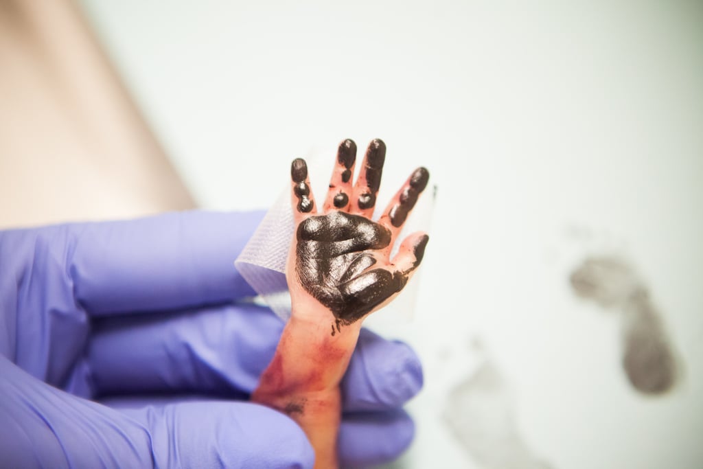 Photos of Baby Born Early at 23 Weeks