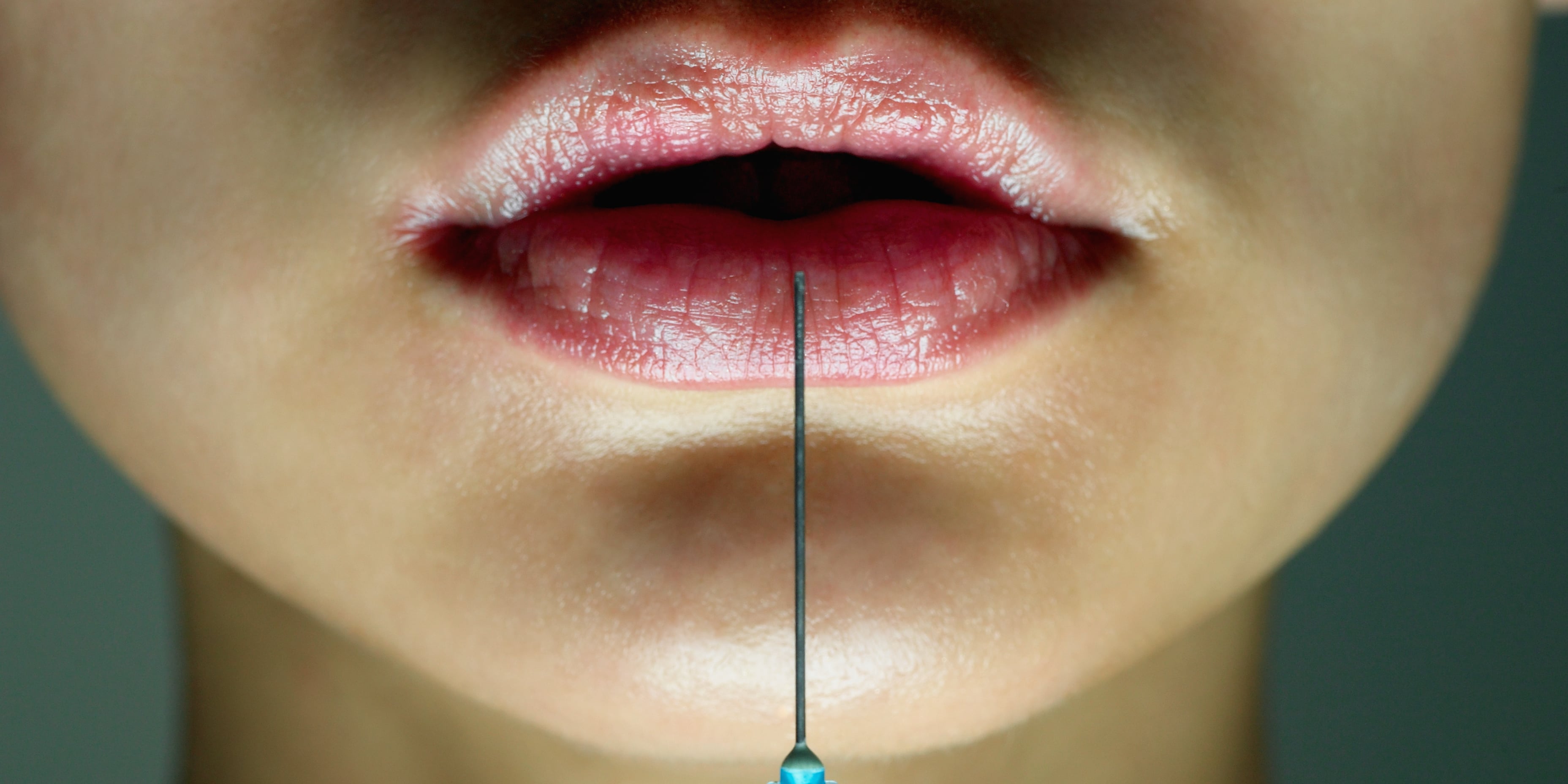 Upper Lip Muscle Twitch 76 - uoa01p9