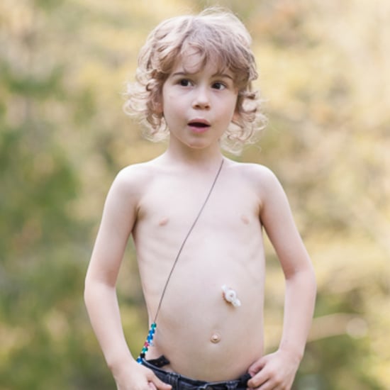 What It's Like to Tube Feed a Child