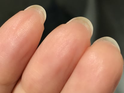 Reason For Skin Growth Under Nails | POPSUGAR Beauty