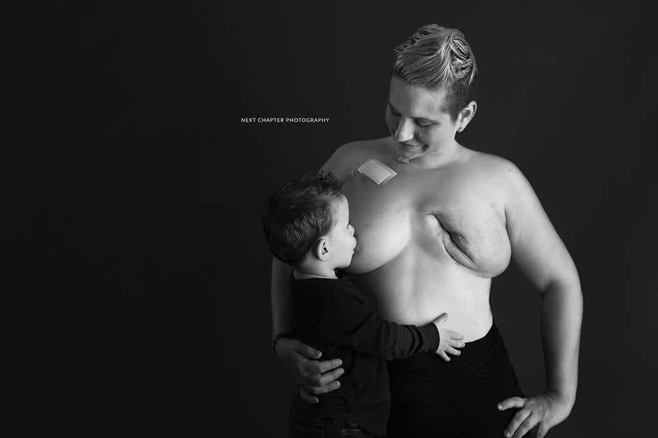 Mom's Photo of Breastfeeding With Breast Cancer | POPSUGAR Family