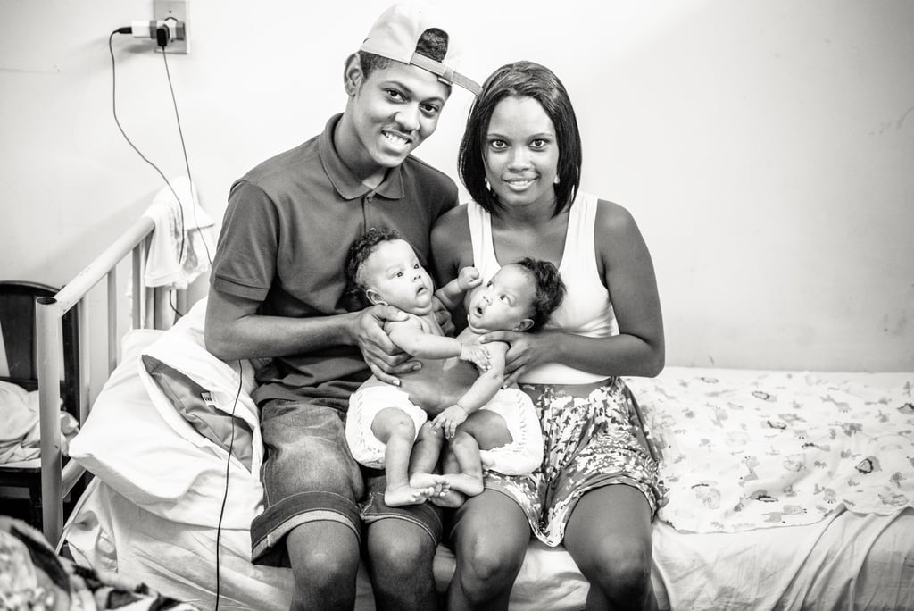 Photographer Captures the Beauty of Conjoined Twins