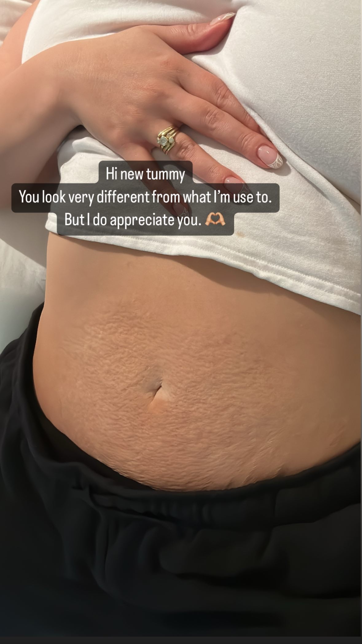 Ashley Graham shows off her postpartum body on Instagram Stories.