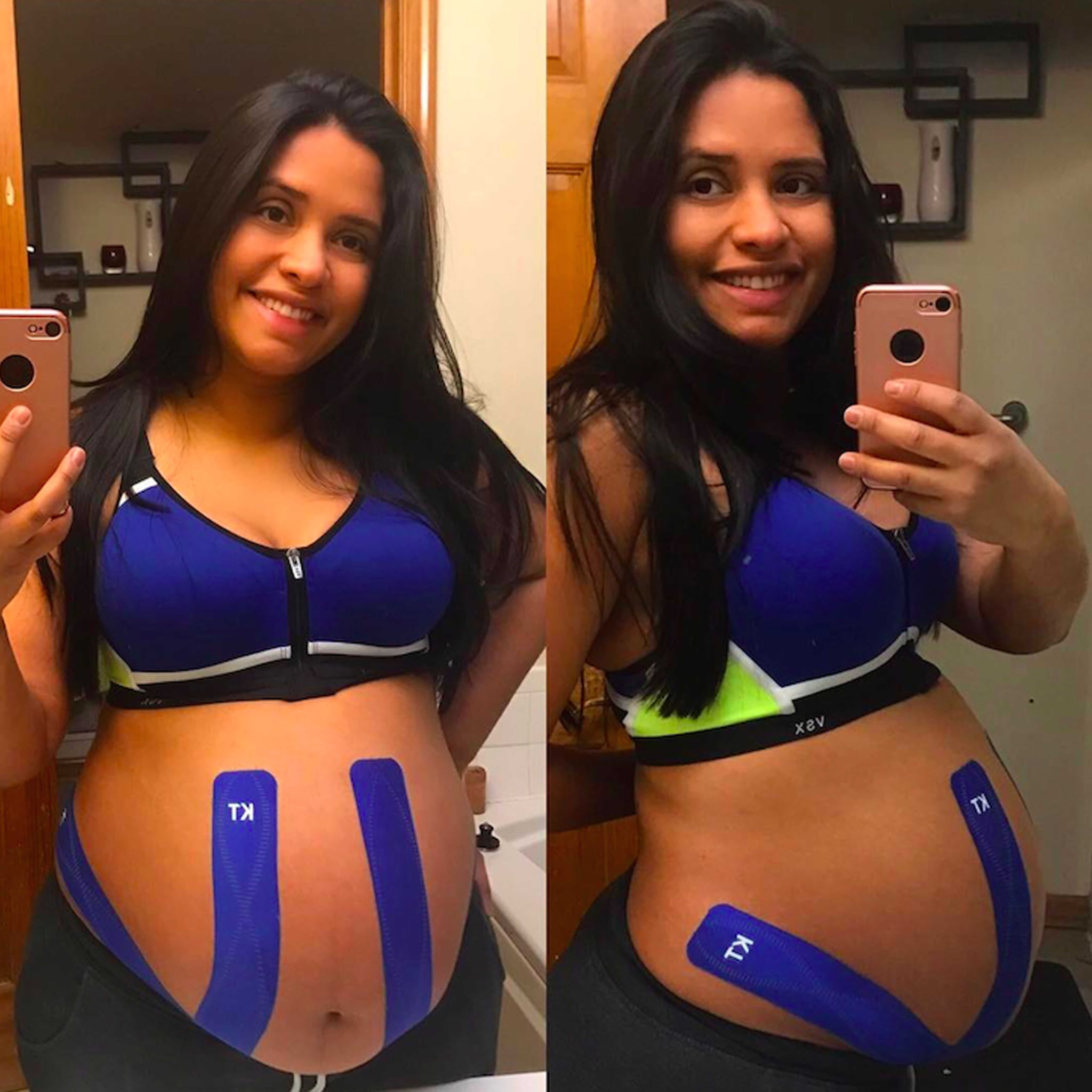 Does KT Tape Work For Pregnancy?