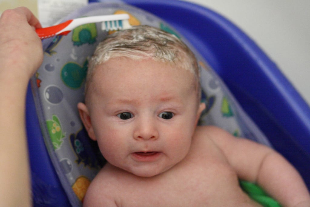 coconut oil for baby cradle cap