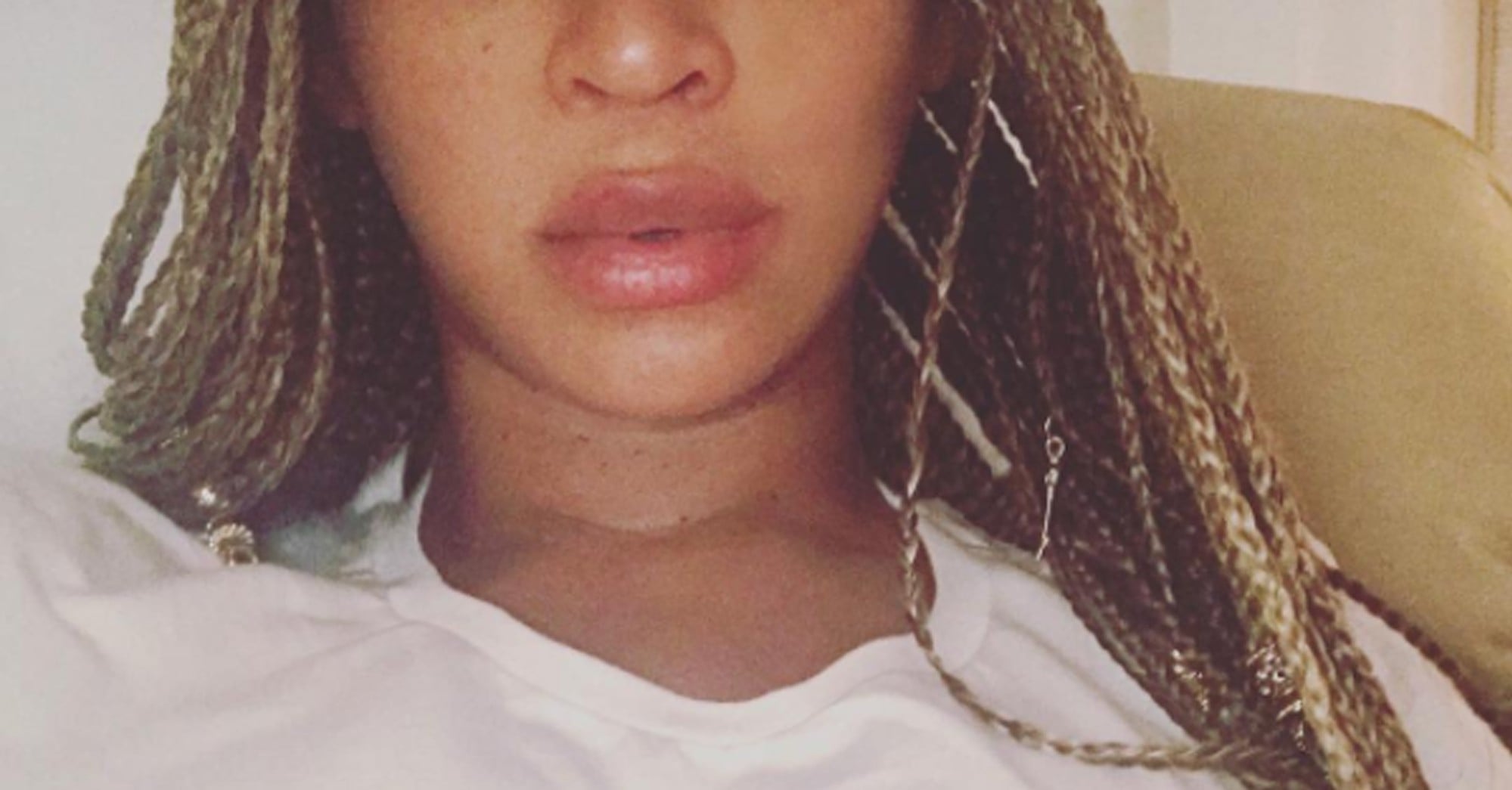 Beyonce Pregnant Lip Injections Rumor Response | PS Family