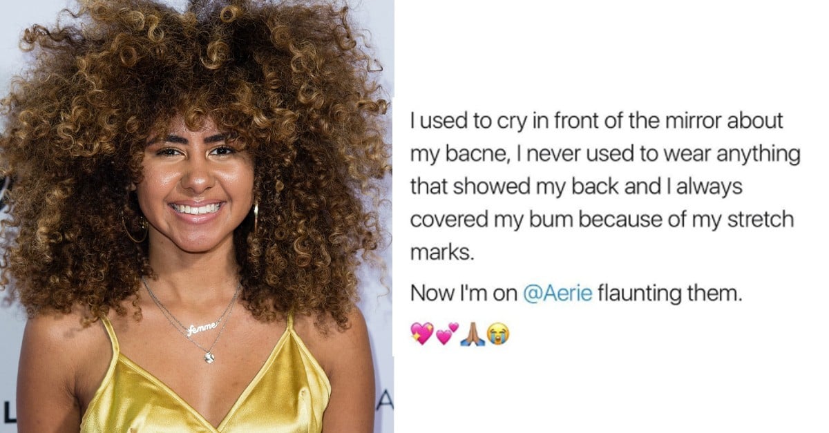 Aerie Model Shows Off Stretch Marks and Bacne