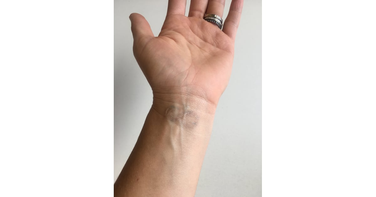 Thinking About Getting Your Tattoo Removed? | What It's ...