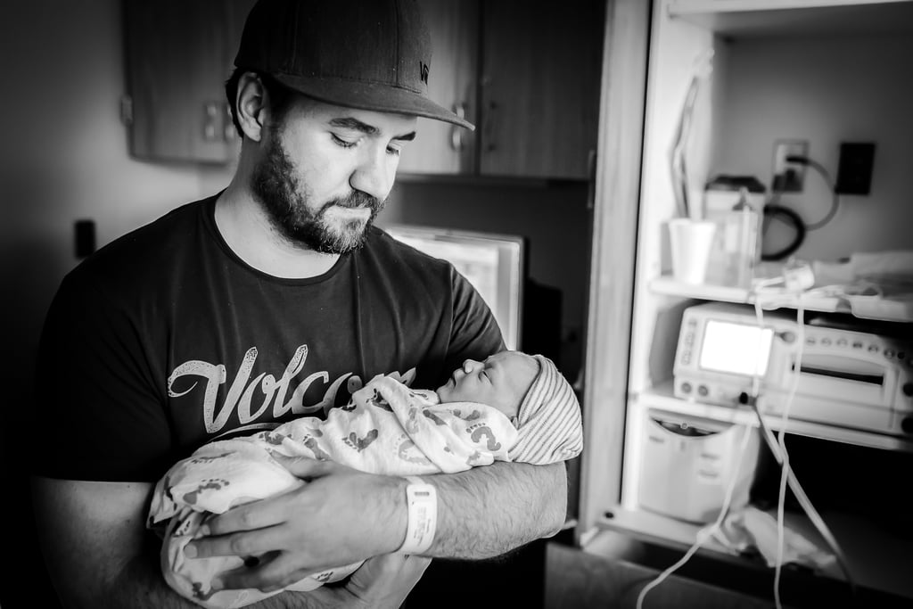 Baby Born With Umbilical Cord Wrapped Around Her Stomach