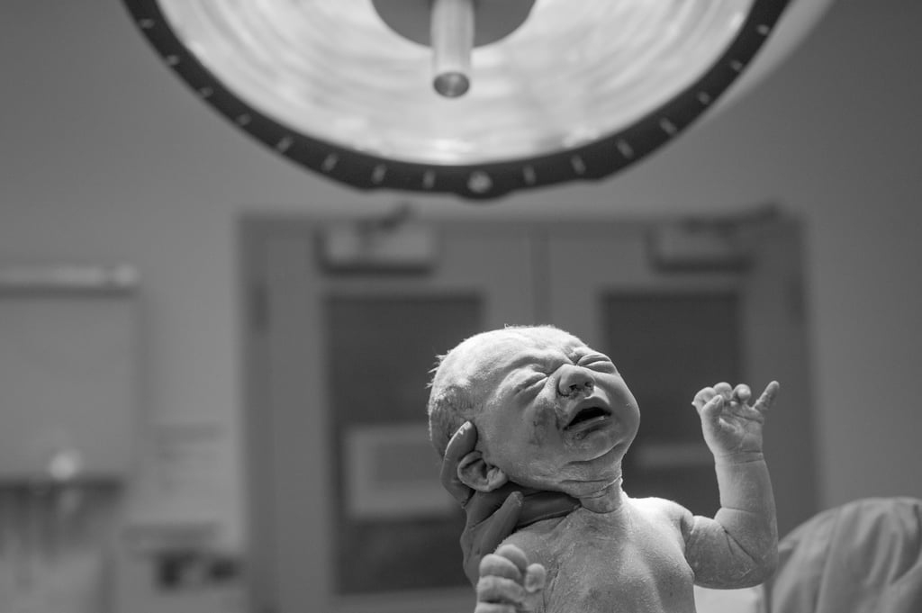 C-Section Birth Story Photo Shoot