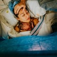 These Photos of C-Section Births Prove That Women’s Bodies Can Truly Withstand Anything