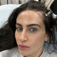 I Tried the Noninvasive Hair-Loss Treatment Alma TED, and It Really Worked