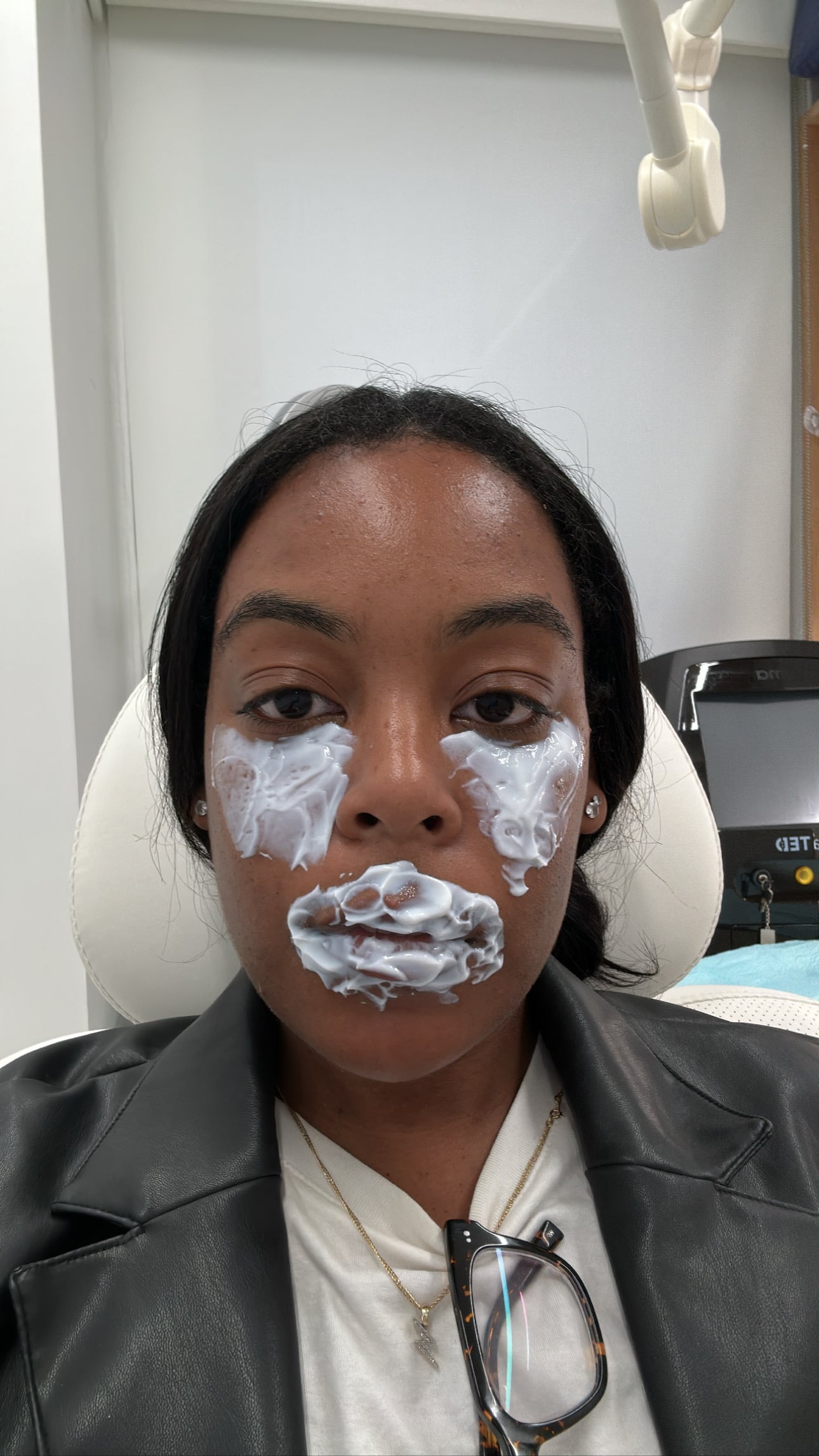 Restylane eyelight filler experiment