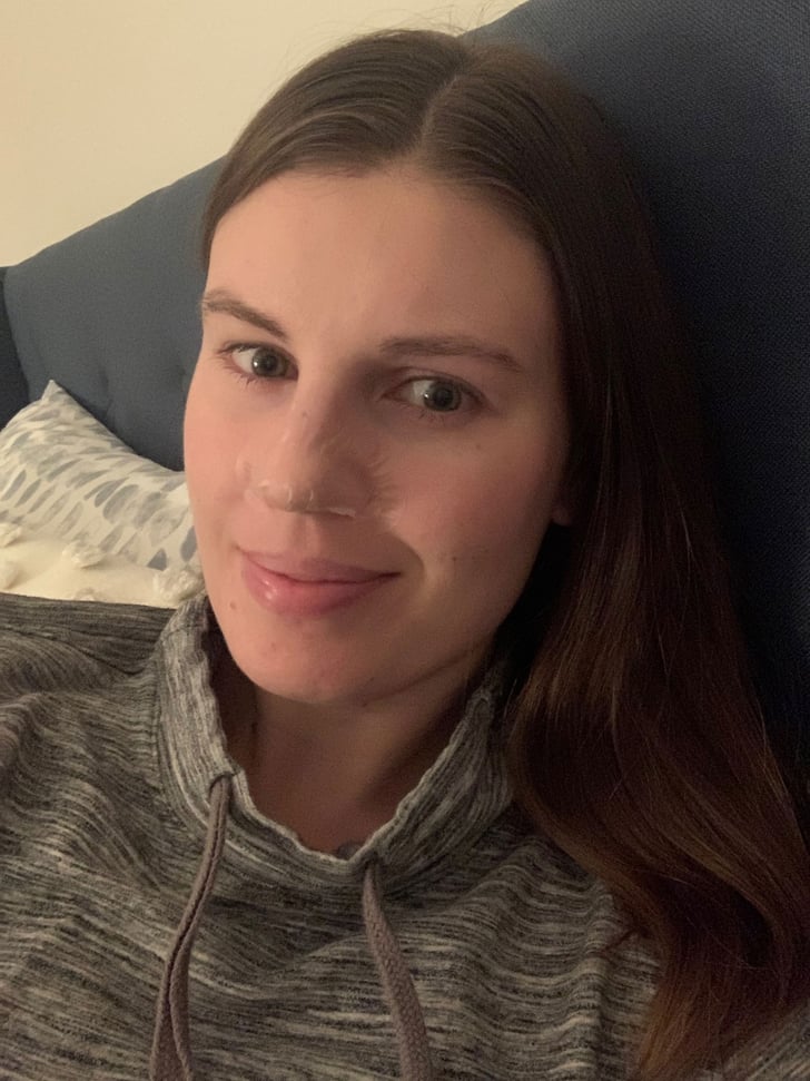 My Experience With Hero Cosmetics Mighty Patch Nose Hero Cosmetics