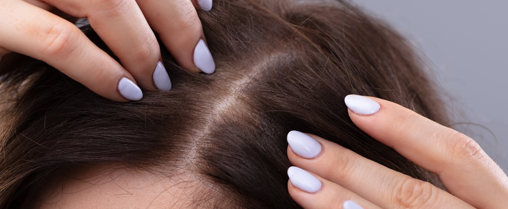 Scalp Psoriasis vs. Dandruff: Experts Explain the Difference