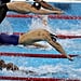 What Is Cupping?