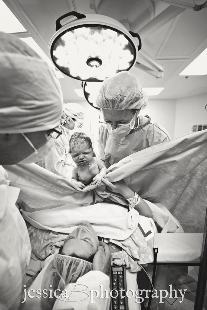C-Section Birth Photography