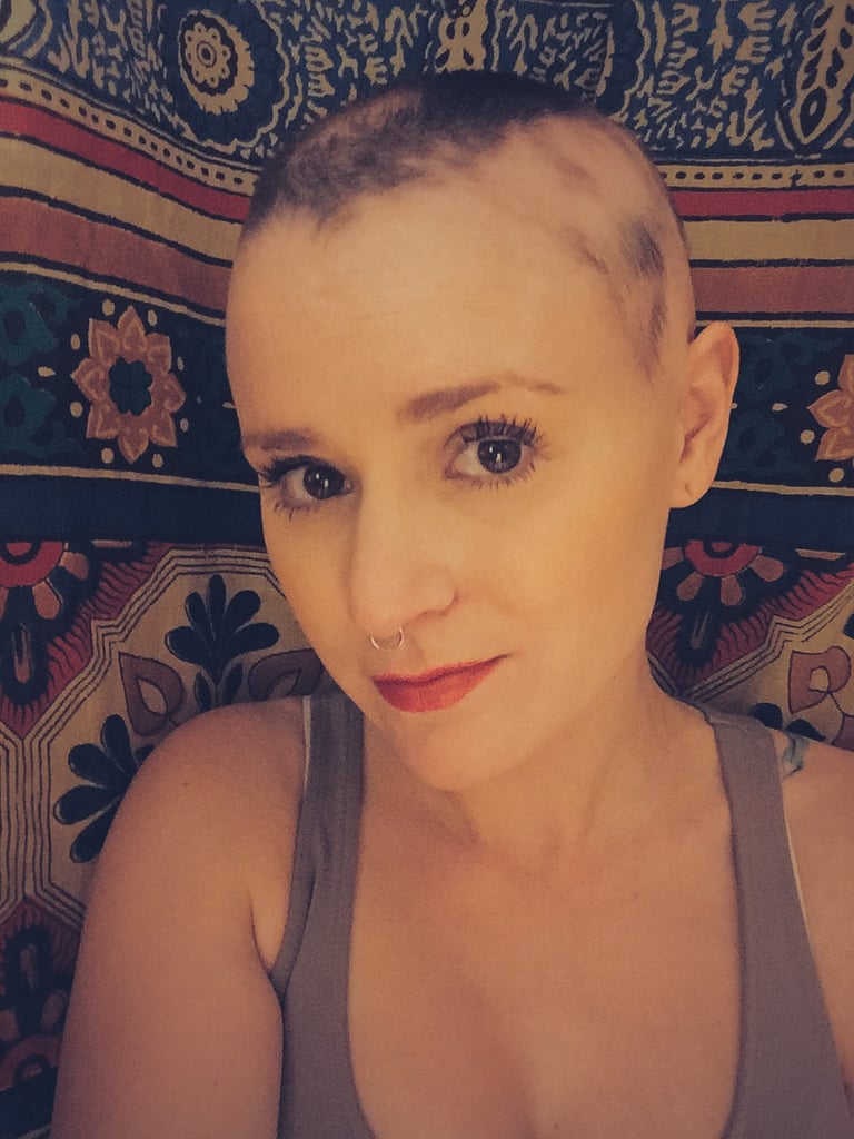 Alopecia Sufferer's GoFundMe Page POPSUGAR Beauty Photo 2