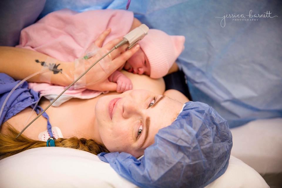 C-Section Birth Photography