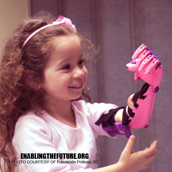 Enable 3D Printed Assistive Limbs