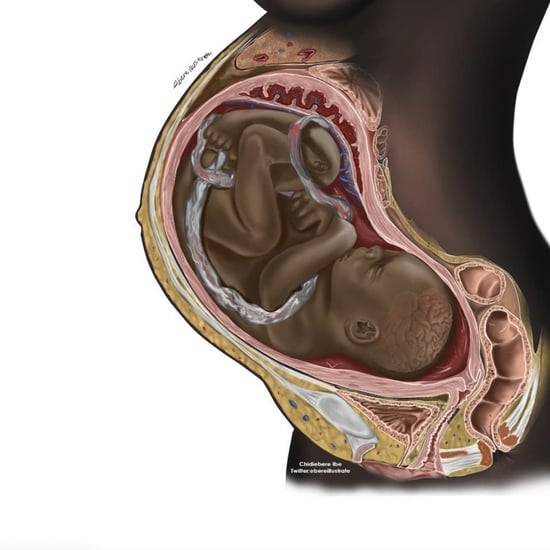 Chidiebere Ibe Black Representation in Medical Illustrations