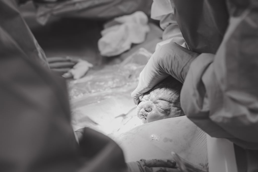 C-Section Birth Story Photo Shoot