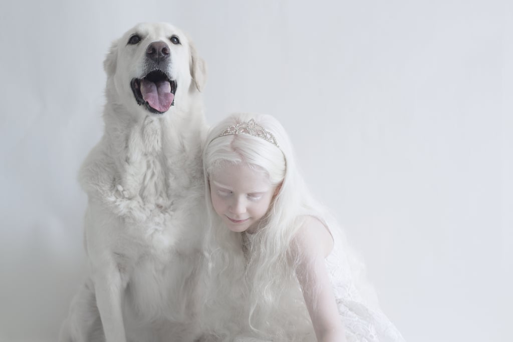 Albinism Photographs | Yulia Taits