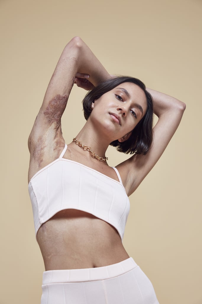 Missguided In Your Own Skin Campaign 2018