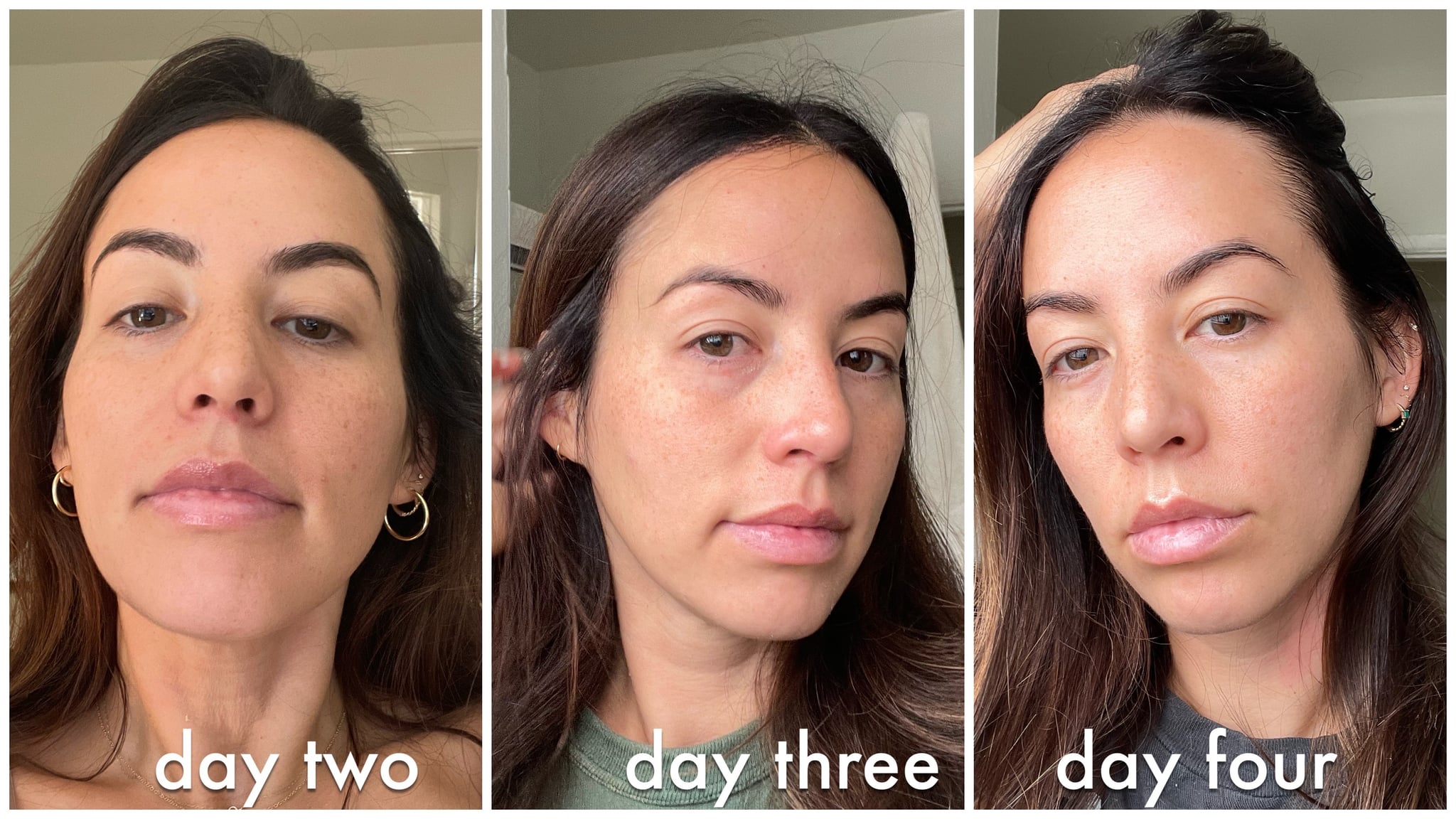 SkinPen Microneedling Editor Experiment