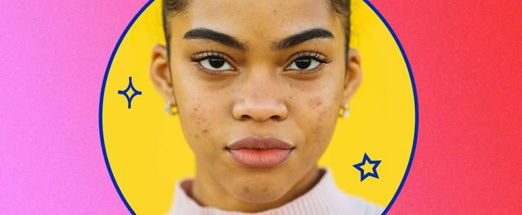Why We Need to Normalize Having Acne