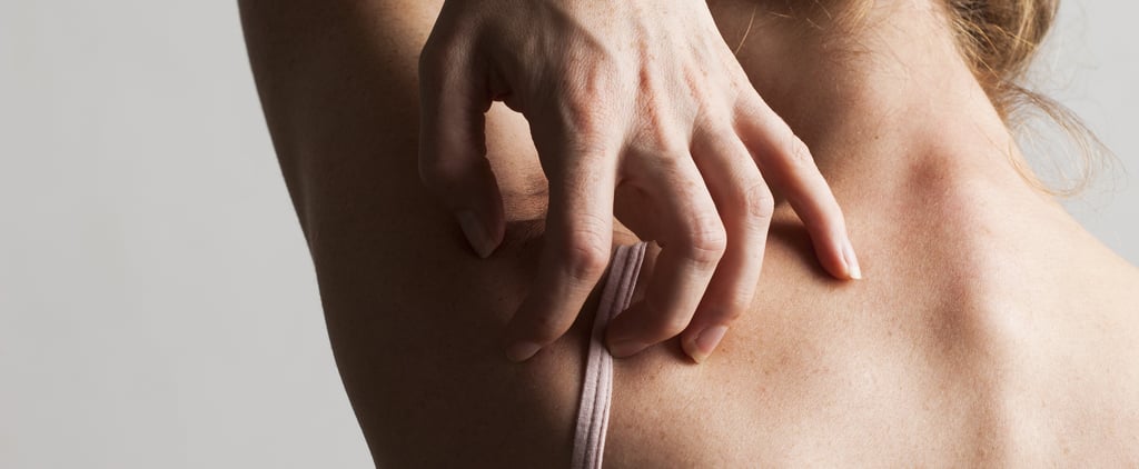 How to Tell the Difference Between Eczema vs. Psoriasis, According to 2 Doctors