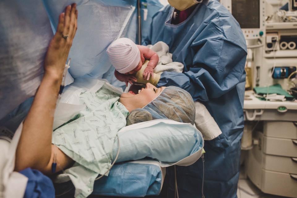 C-Section Birth Photography