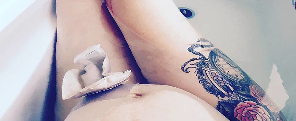 Mom's Selfies With Ileostomy Bag