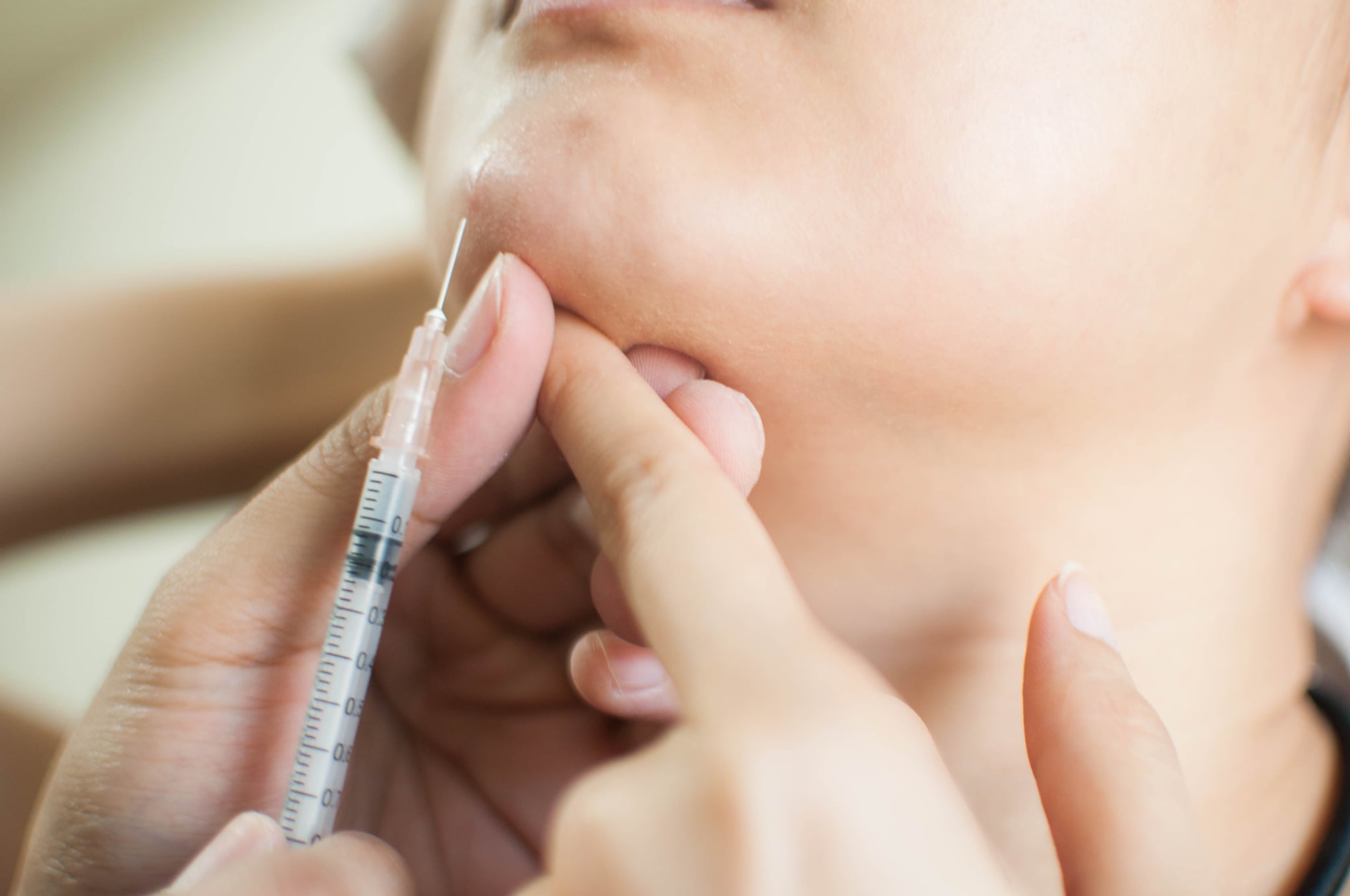 Close-up of hand injecting medicine to a woman's acne