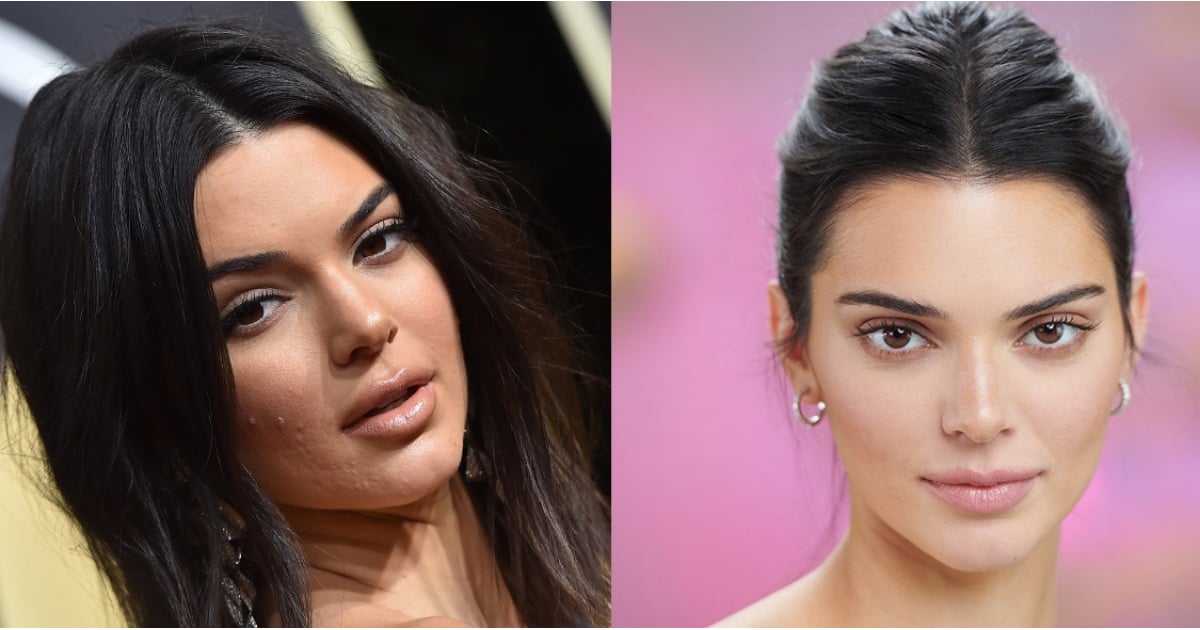 Kendall Jenner Proactiv 19 Popsugar Beauty