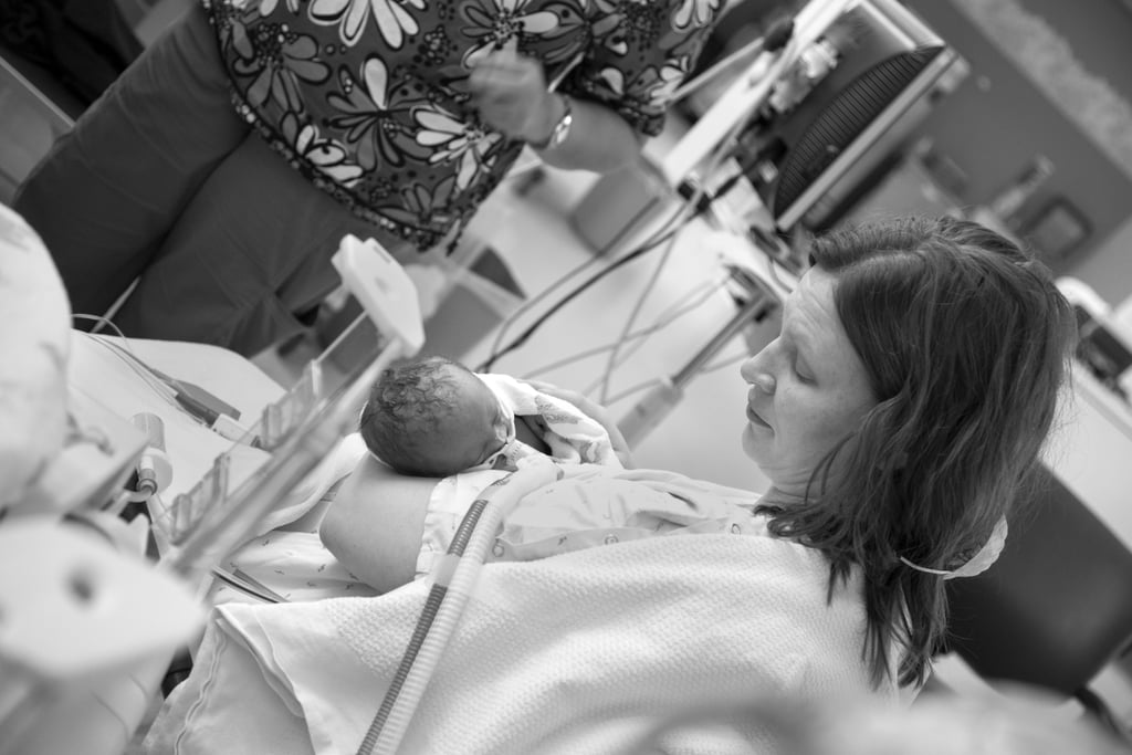 Trisomy 13 and 18 Baby Photos