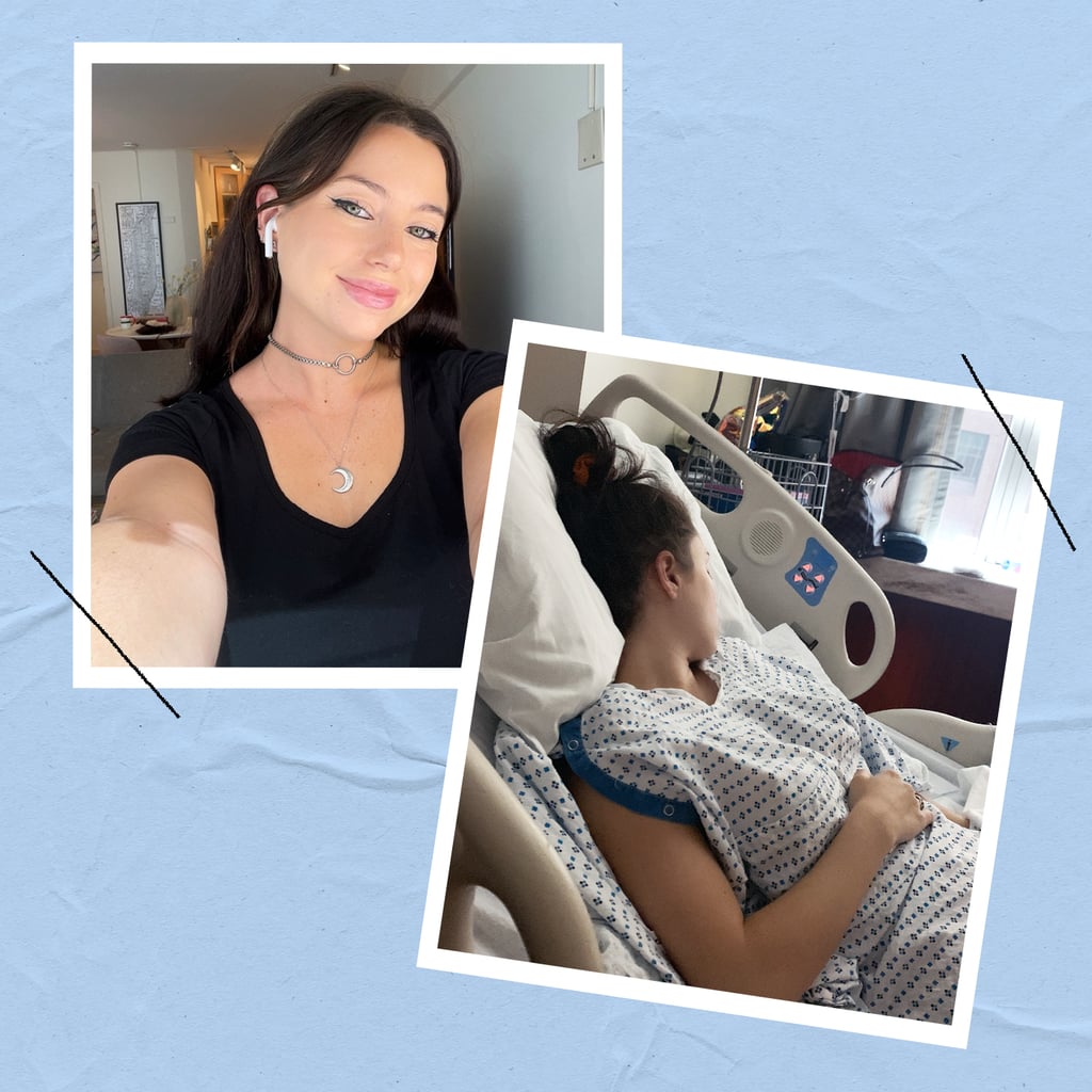 I Had a Massive Fibroid Removed at 21 and Learned to Never Ignore My Body Again