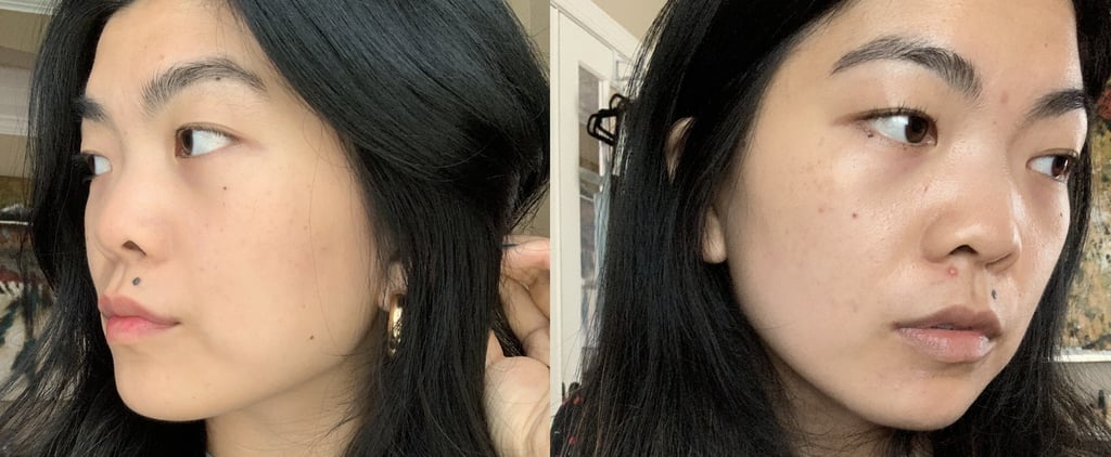 Curology Skin-Care Review