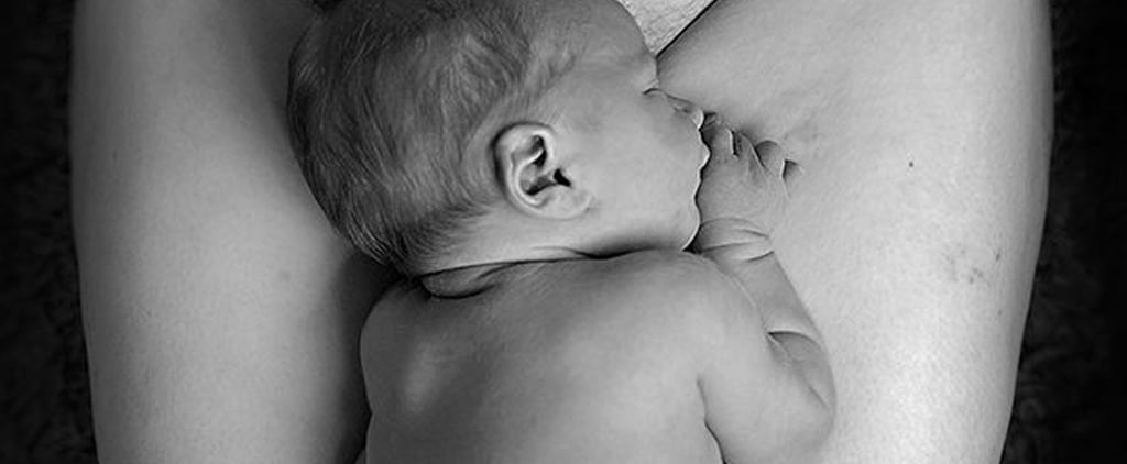C-Section Photo That Went Viral