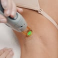 What to Know Before Getting Underarm Laser Hair Removal