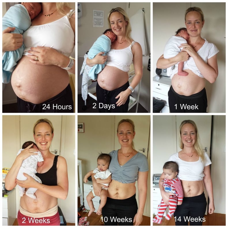 When will my postpartum belly go away? - Today's Parent