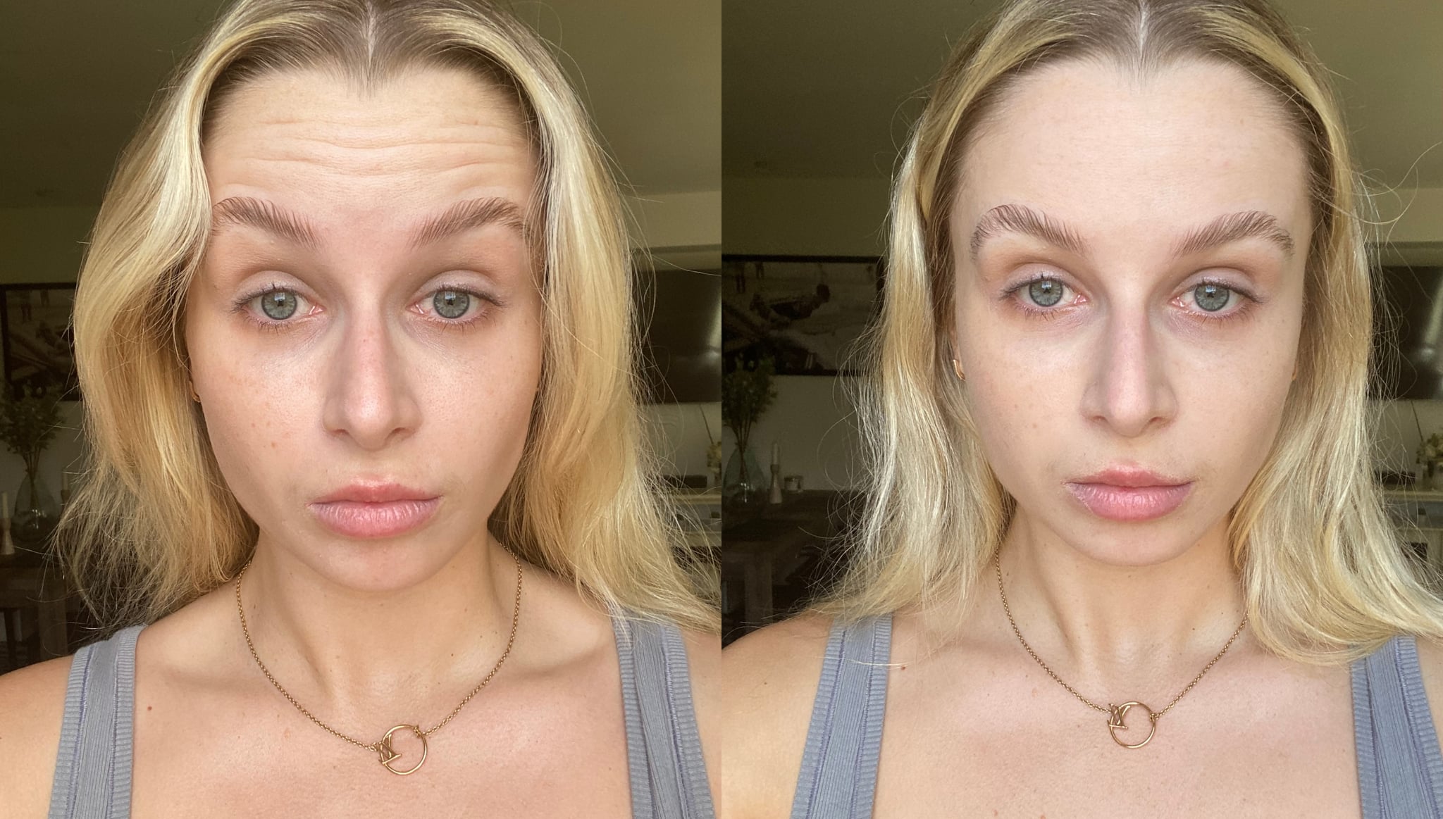 Before and after using the Nakery Beauty Instant Wrinkle Eraser