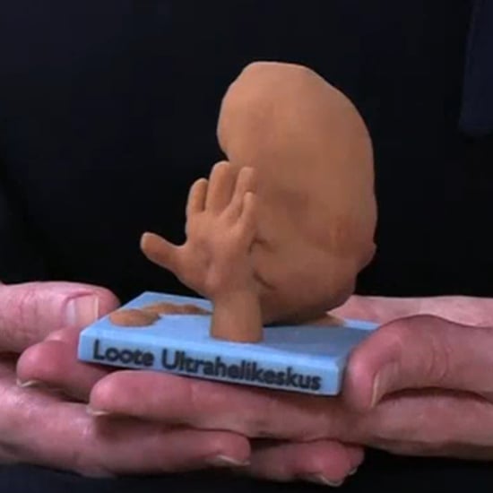 3D Printed Fetus Sculpture Trend