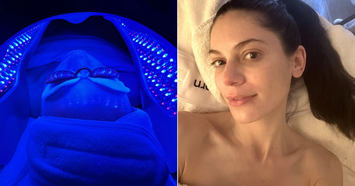 I Tried a ,600 “Liquid Facelift” — Was It Worth It?