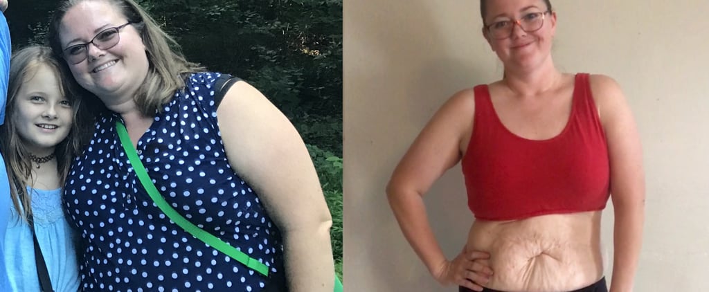 I Lost So Much Weight That I Have Loose Skin, and Honestly, What About It?
