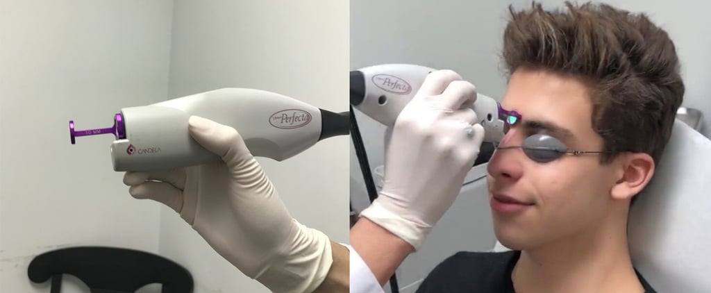 How to Get Rid of Acne With Lasers
