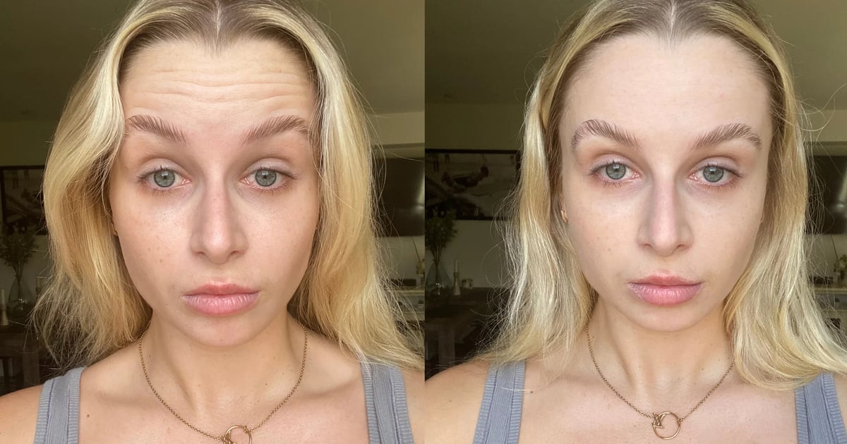 Beauty Hype Check
