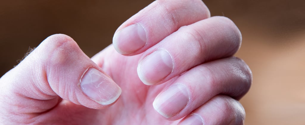 Nail Psoriasis vs. Fungus: Experts Explain the Differences