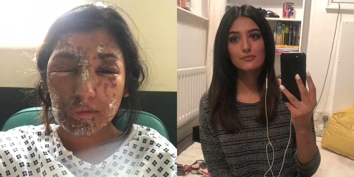 Resham Khan Acid Burn Victim Takes Makeup Free Selfie Popsugar Beauty