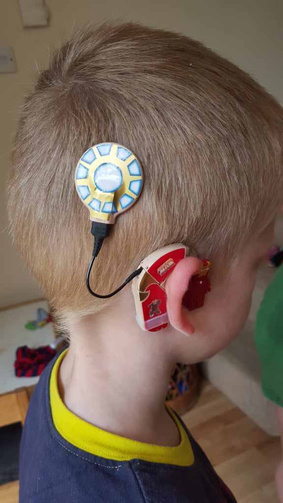 Mom Creates Superhero Hearing Aids For Son